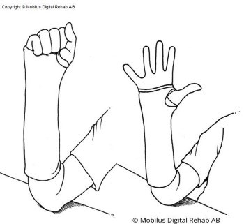 En underarm med gips placerad med armbågen på ett bord. Fingrar som böjs respektive sträcks. 